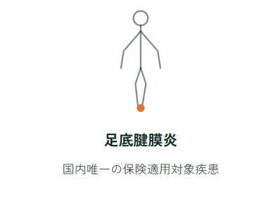 足底腱膜炎、国内唯一の保険適用対象疾患