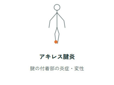 アキレス腱炎、腱の付着部の炎症・変性