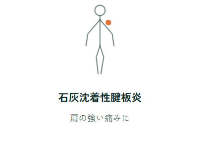 石灰沈着性腱板炎、肩の強い痛みに
