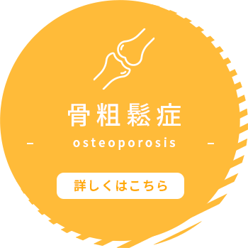 骨粗鬆症